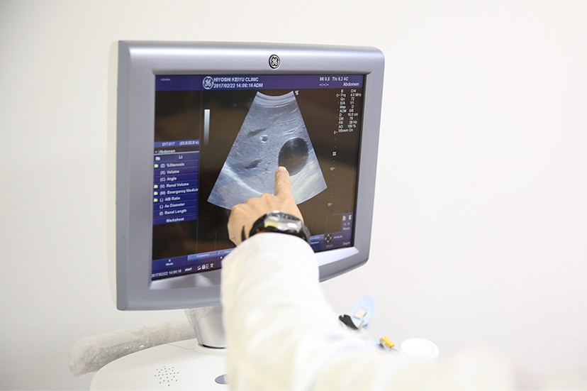 超音波検査（エコー）